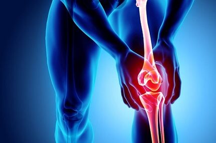 Arthritis