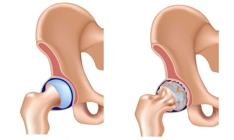 Healthy joints and joints