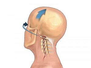 How does cervical joint disease manifest