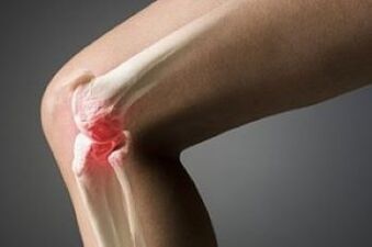 Arthrosis of knee joints is a tricky injury
