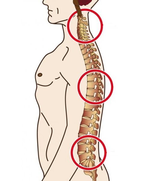 The spine faculty in it occurs