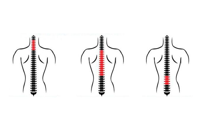 How does osteochondritis manifest