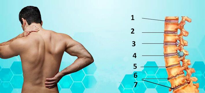 stages of development of osteoarthritis